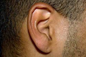 Bourdonnement D’oreille : Les Causes Et Les Solutions